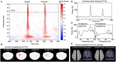 Aberrant Sensory Gating of the Primary Somatosensory Cortex Contributes to the Motor Circuit Dysfunction in Paroxysmal Kinesigenic Dyskinesia